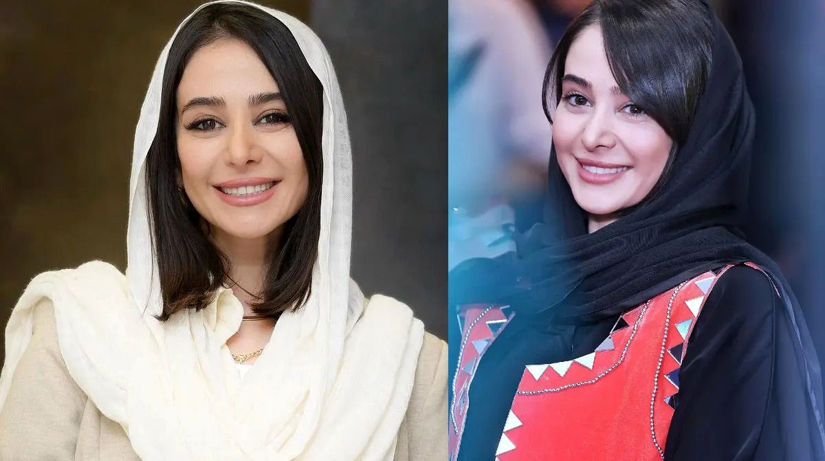 عکس قدیمی از الناز حبیبی قبل از عمل زیبایی