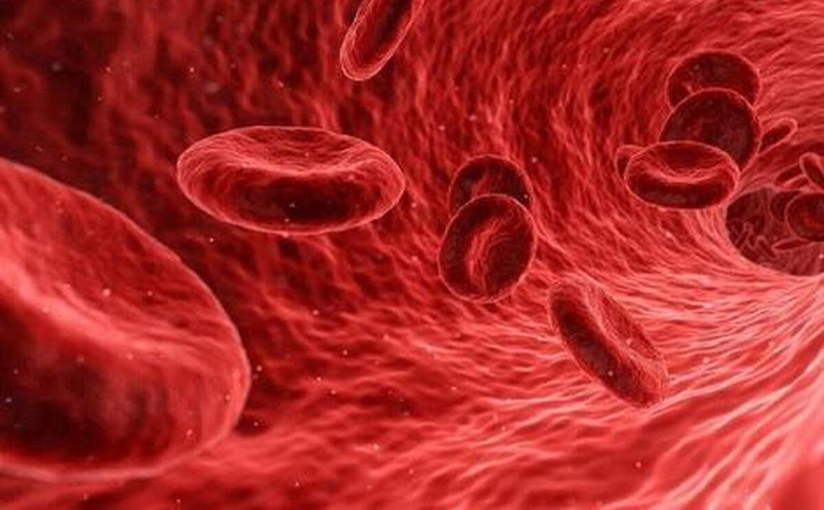 اگه کم خونی این مواد غذایی رو بخور | بگو چه مشکلی داری تا بگم چی بخوری؟