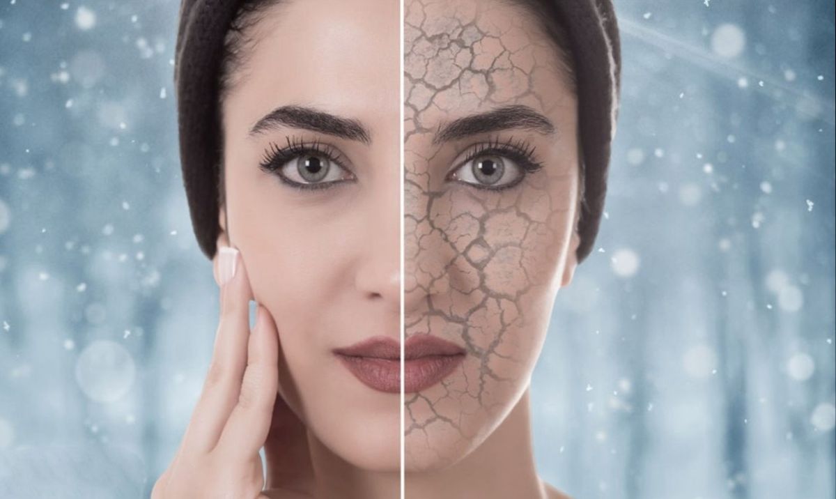 ۵ روش درمان خشکی پوست در زمستان | با این روشها از پوست خود مراقبت کنید