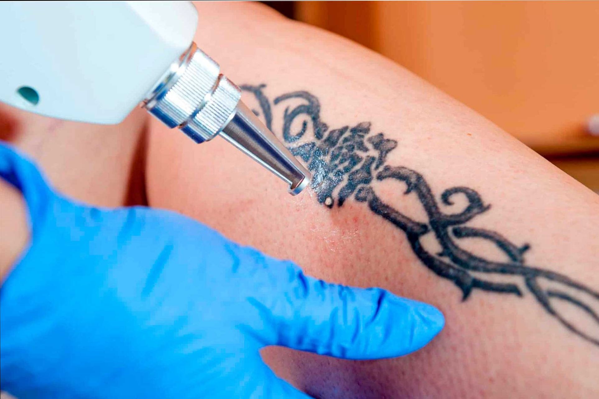 خالکوبی این بلا را سرتان میآورد