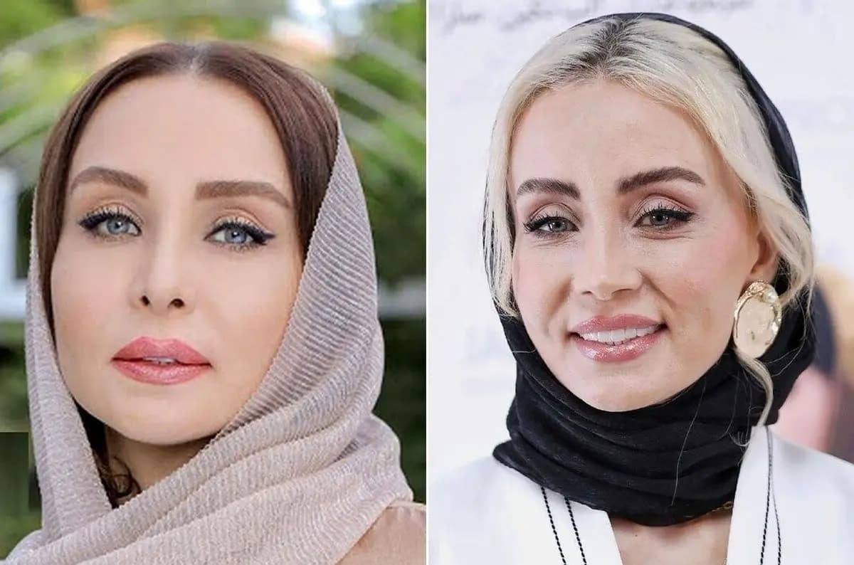 ادعای عجیب حدیث فولادوند: عمل زیبایی نکردهام +فیلم