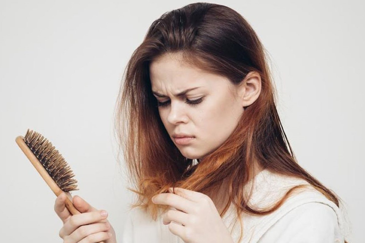 ۳ خوراکی که ریزش مو را بدتر میکنند؛ از نوشابه تا الکل
