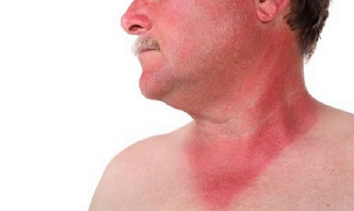 چطور در روزهای گرم تابستان عرق‌سوز نشویم؟