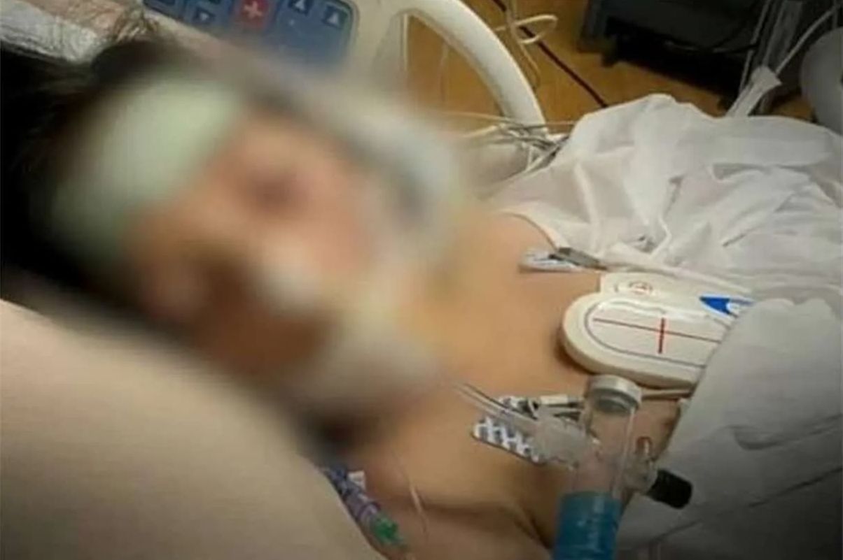 قتل پسربچه ۵ ساله افغانستانی در پی کودک‌آزاری پدرش