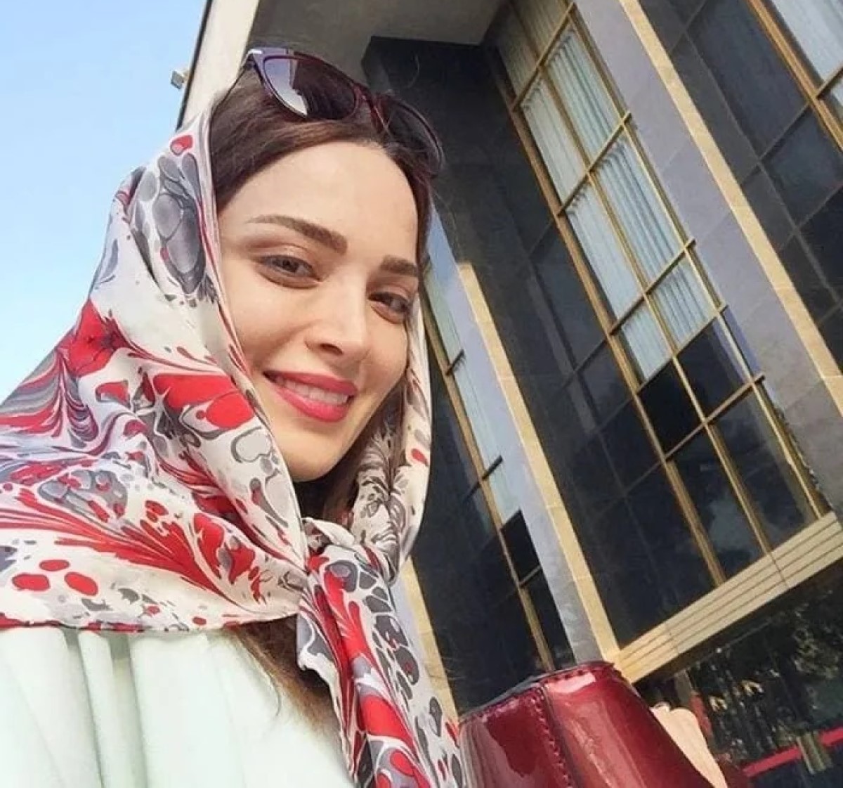 بهنوش طباطبایی با دندان‌های خرگوشی در کودکی+عکس