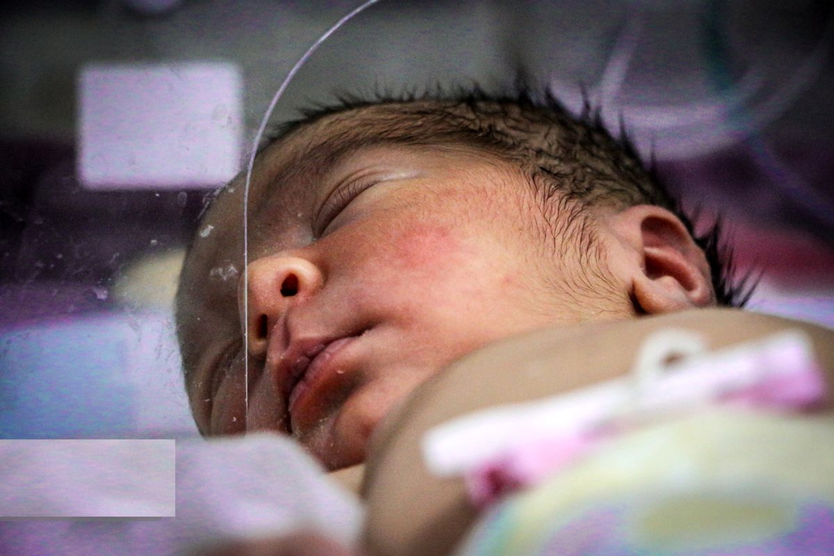 شکستن دست نوزاد هنگام تولد در اثر قصور پزشکی