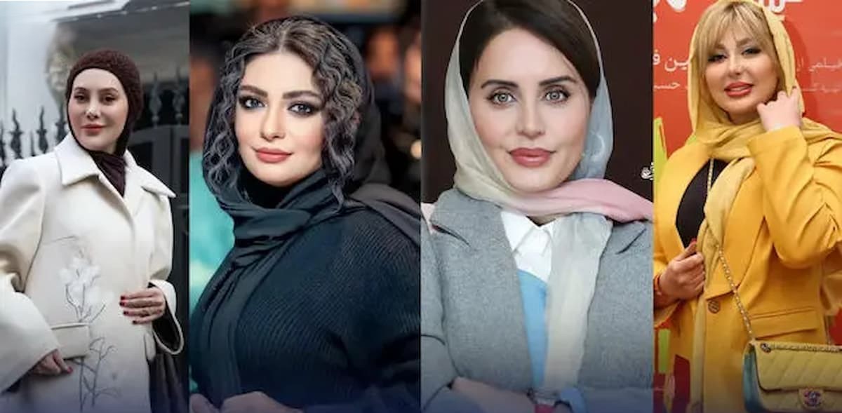 آلبوم عکس امروز | استایل‌های پاییزی ترند الناز شاکردوست، لیندا کیانی، آرام جعفری و نیوشا ضیغمی