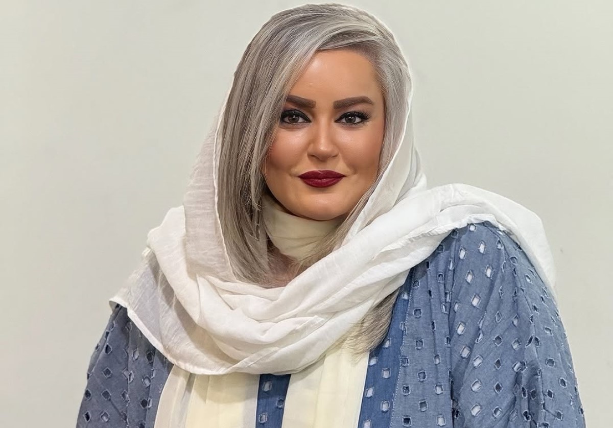 ماشین بنز نعیمه نظام دوست ستاره پرانرژی جوکر؛ اسکورت نعیمه از پارکینگ تا کلینیک زیبایی