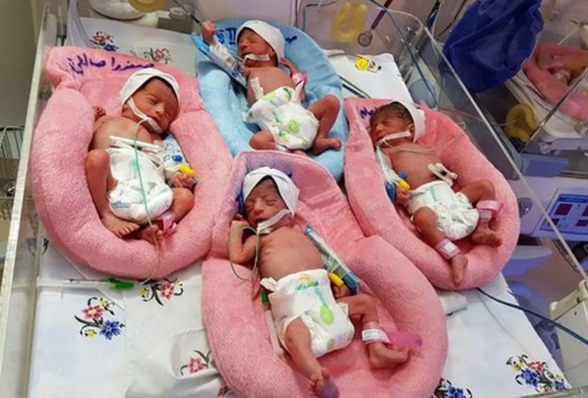 تولد نوزادان 6 قلو توسط مادر ۲۳ ساله مشهدی؛ یک نوزاد فوت کرد