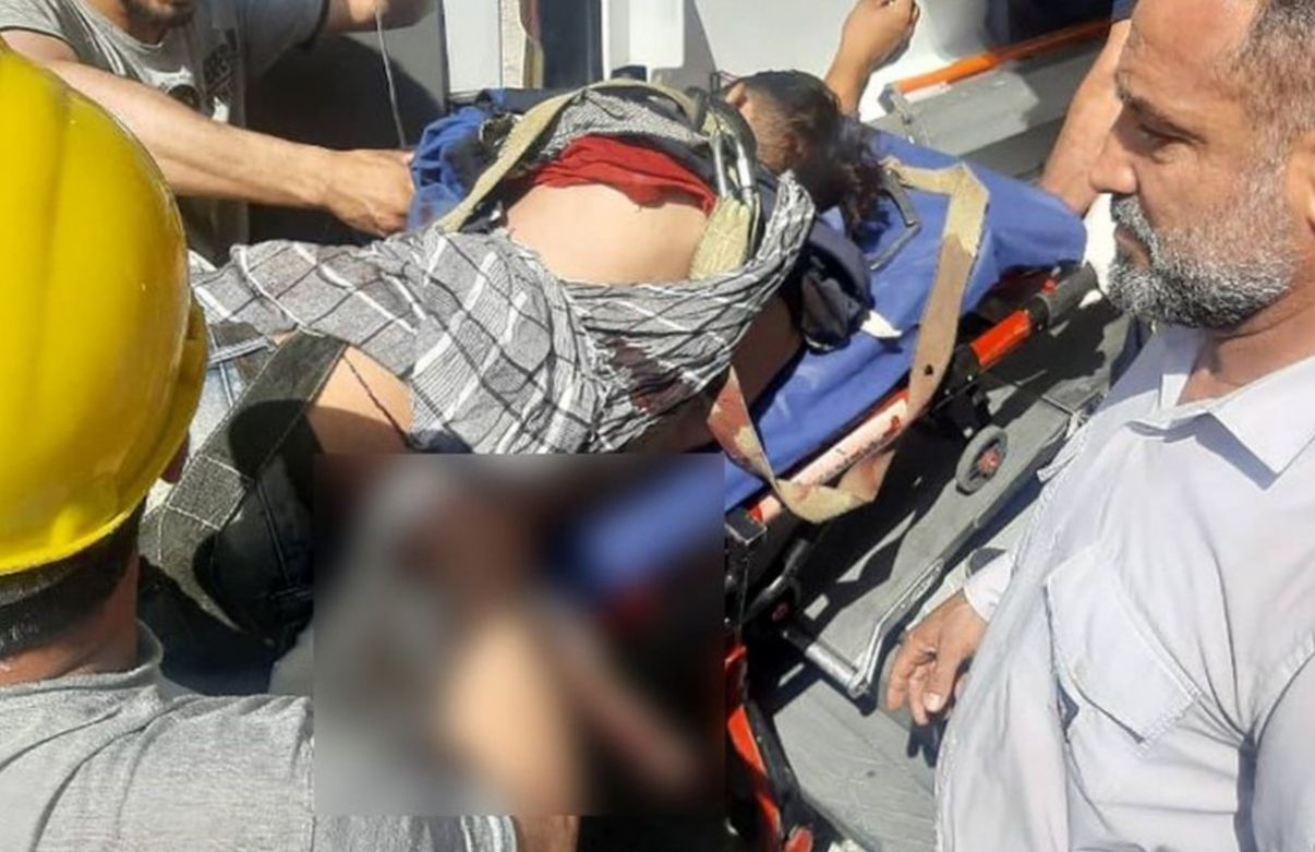 تصویر دلخراش از حادثهای وحشتناک؛ میلگرد در بدن کارگر ۲۵ ساله!